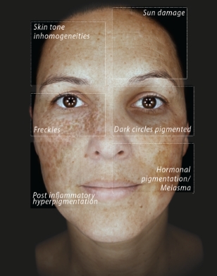 3-Analysis-Modes-Pigmentation-02-01